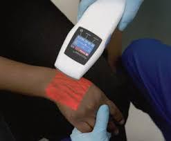 Venipuncture Device