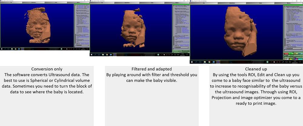 3D converted and cleaned ultrasound file