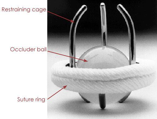 EMEA (Europe, Middle East and Africa) Heart Valve Devices Market Report 2017 - Abbott Laboratories, Boston Scientific, Medtronic & St. Jude Medical