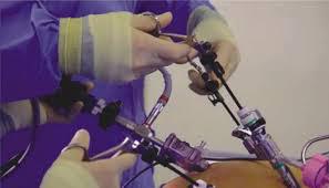 Shares of Obesity Surgery Devices Market in Global Industry : Overview, Research and Trends 2017