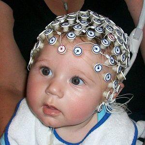 Baby EEG Cap Market