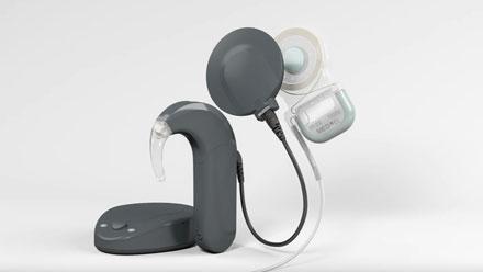 Cochlear Implant (CI) System Market