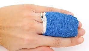 Negative Pressure Wound Therapy Market Report for Period 2017 till 2022 Triage Meditech, WuHan VSD, Talley Group and Others