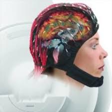 Global Wireless EEG Headset Market 2017 - COGNIONICS, INC., NeuroSky, Compumedics Limited