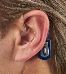 Nov, 8 2017: Wireless Hearing Aid Market Forecast 2023 Zounds Hearing, Sonova Holding, Cochlear, Widex, Sivantos Pte