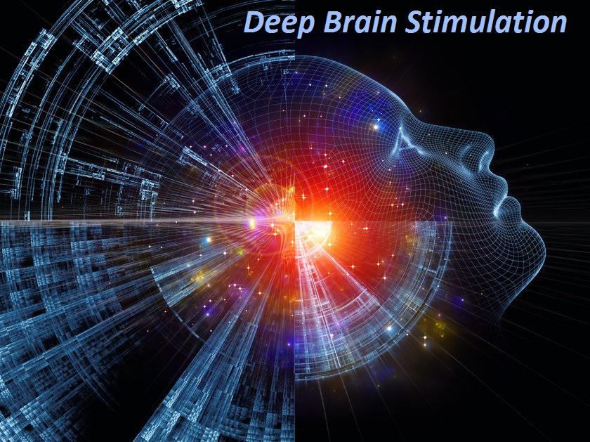 Deep Brain Stimulation Devices Market Analysis On the basis
