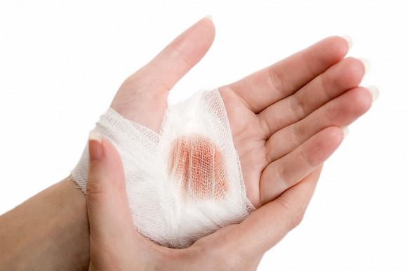Global Burn Care Market is expected to reach 3,253.99 million by 2024