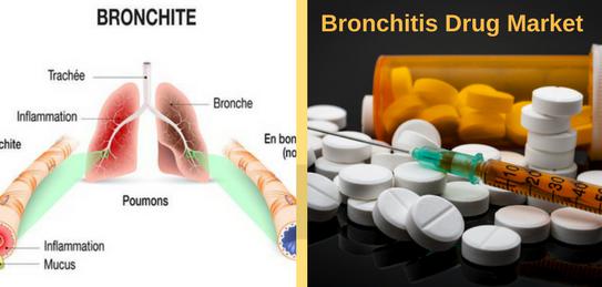 Global Bronchitis Drug Market Professional Survey Report 2018