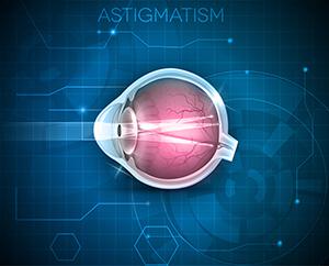 Astigmatism Market 2018: Key Players Novartis AG, Johnson &