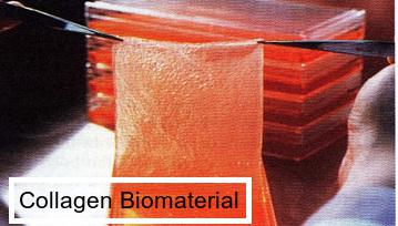 Collagen Biomaterial Industry Summit to Showcase New