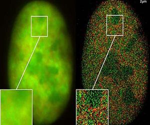 Global Fluorescence Lifetime Imaging Microscopy Market