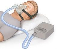 Snoring Control Device Market