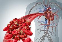 Anticoagulants, Anticoagulants Market, Anticoagulants Market Size, Anticoagulants Industry, Anticoagulants Market share