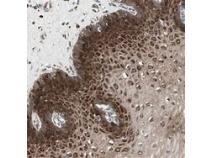 Global STAB1 Antibody(Stabilin-1 Precursor) Industry Research Report, Growth Trends and Competitive Analysis 2013-2025