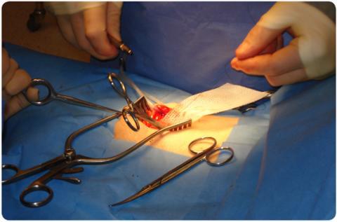 soft tissue repair market to grow at a CAGR of 8.3% from 2018 to 2025 and to reach US$ 6,677.0 Mn in 2025