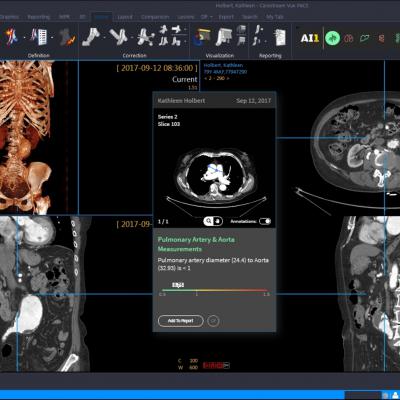 Medical Imaging Software Market Report 2018 Companies included Bruker Corporation; Xinapse Systems Ltd.; Esaote Inc.; ClaroNAv Inc.; Merge Healthcare Inc.; Aquilab GmbH; Spacelabs Healthcare Inc.; MIM Software Inc.; Carestream Health Inc. and Others