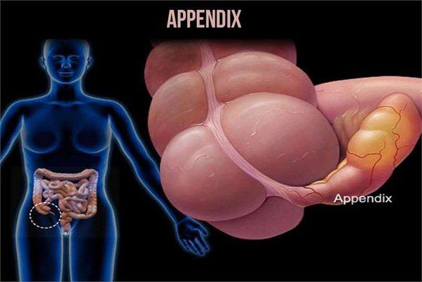 Appendicitis Market