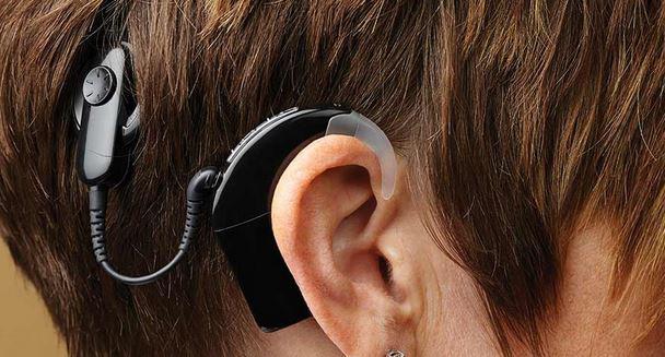 Hearing Implant Market, Hearing Implant Market trends, Hearing Implant Market forecast, Hearing Implant Market Analysis, Hearing I