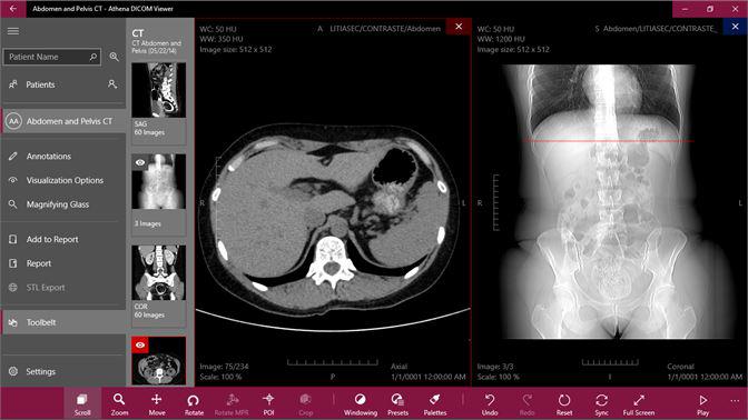 New report On Enterprise Medical Image Viewers Market Global Forecast 2018 Estimated with Key Players like GE Healthcare, Philips,