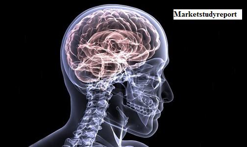 Brain Monitoring Devices Market, Brain Monitoring Devices Market Trends, Brain Monitoring Devices Market Growth, Brain Monitoring