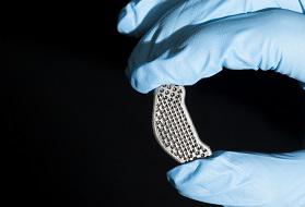 3D Printing Medical Device Industry, Global 3D Printing Medical Device Market, 3D Printing Medical Device Market Size