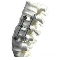Asia Pacific Spinal Implants Market