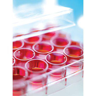 Stem Cell Media Market Report 2018 Companies included Thermo Fisher, STEMCELL Technologies, Merck Millipore, Lonza, GE Healthcare, Miltenyi Biotec, Corning, CellGenix, Takara, PromoCell and Others
