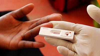 HIV & AIDS Testing market status, competition landscape, market share, growth rate, future trends, market drivers, opportunities