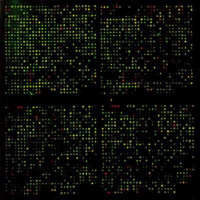 Global dna microarray Market Report 2018 Companies included Illumnia, Affymetrix, Agilent and Others