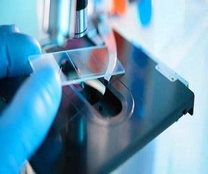 Global Hospital-Acquired Disease Testing Market