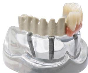 Global Dental CAD/CAM & Dental Prosthesis Market