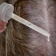 Global Hair Loss Medications Market 2019