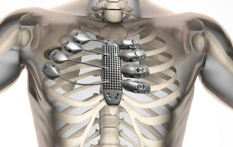 3D Printing Medical Devices Market growing at a CAGR of 17.13% from 2017 to 2025