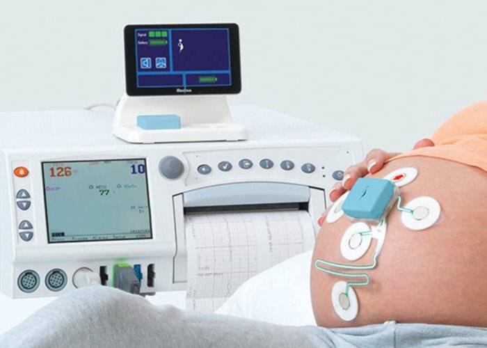 Global Fetal Monitoring Market Skilled Survey Report 2019