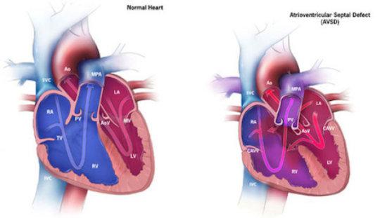 Global Congenital Heart Diseases Market 2019 Key Players, SWOT