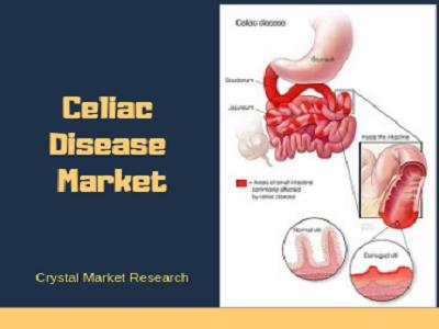 Celiac Disease: Development in the predominance In Healthcare Industry; Johnson & Johnson, Bristol-Myers Squibb, Roche Holding AG, Novartis, Pfizer