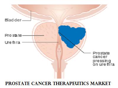 Prostate Cancer Therapeutics Market