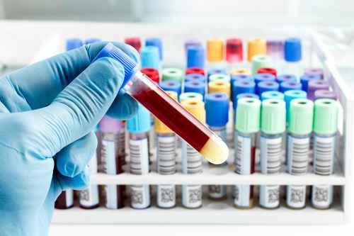 Offering Top Cardiologist in Pune