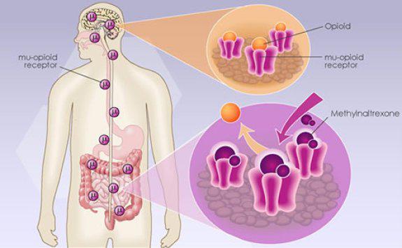 Opioid Induced Side Effects Treatment Market