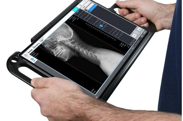 Wireless DR Detector Industry Market 2019 Key Player Analysis – Philips, Healthcare Positron Corporation, Siemens Healthcare, Tosh