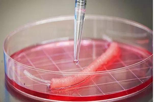 Comprehensive Analysis On Tissue Engineered Skin Substitutes Market 2019 : Amarantus BioScience Holdings, BSN medical, Integra Lif