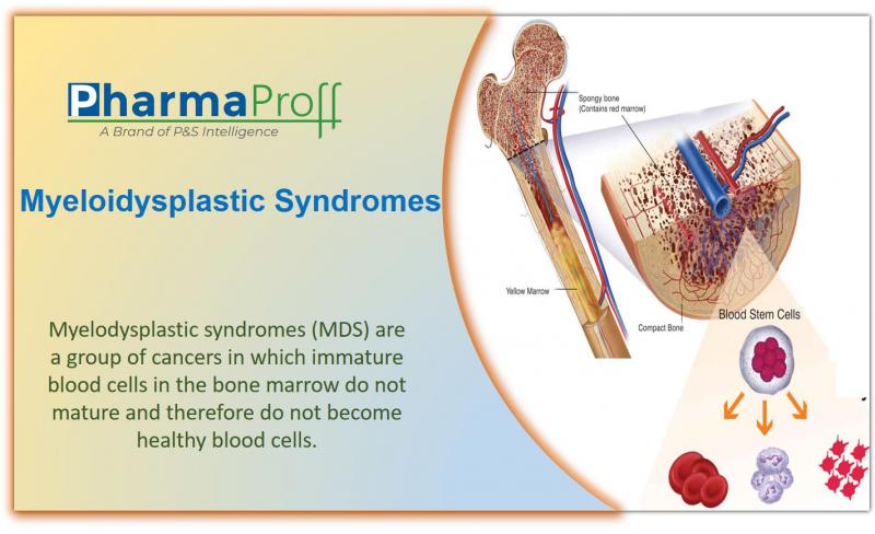 Myeloidysplastic Syndromes (MDS) – Epidemiology Insights