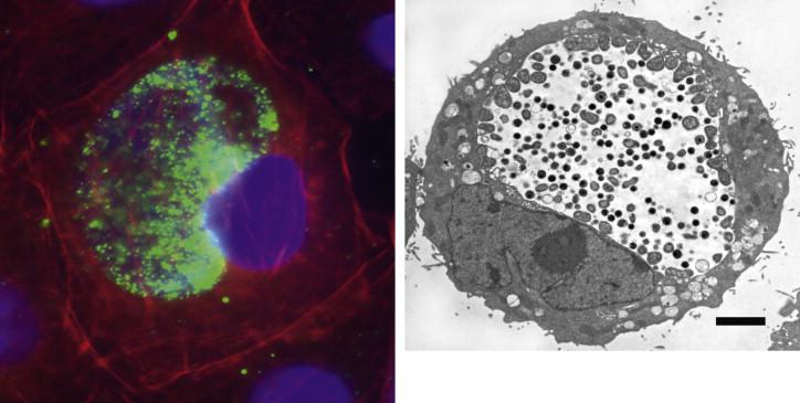 Chlamydia Trachomatis And Neisseria Gonorrhoeae (CT/NG) Molecular Diagnostics Market