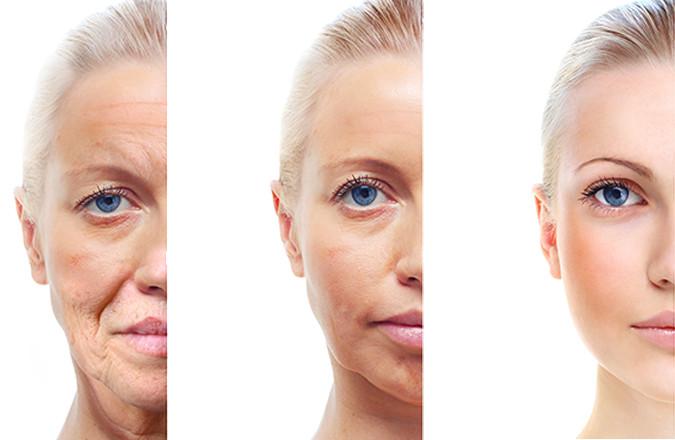 Global Anti-Aging Cosmetics Market, Top key players are Loreal