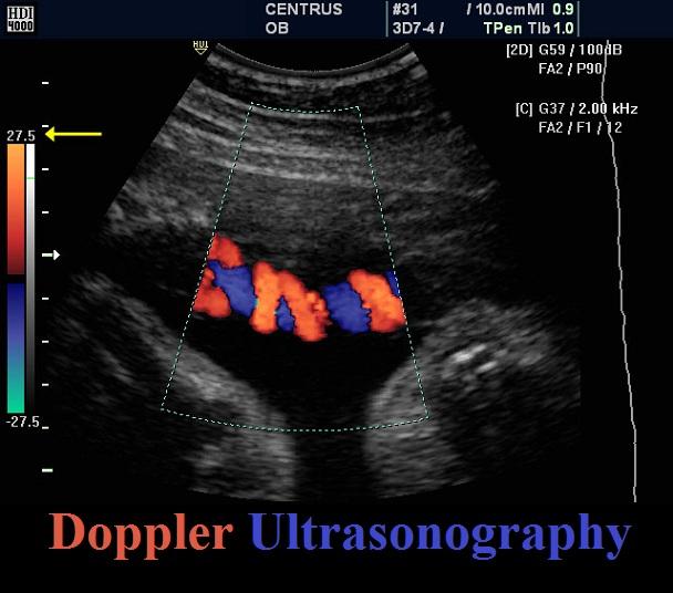 Doppler Ultrasonography Market