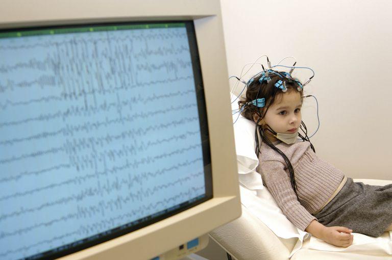 Global Lennox-Gastaut Syndrome Treatment Market 2019, Global Lennox-Gastaut Syndrome Treatment Market Growth,