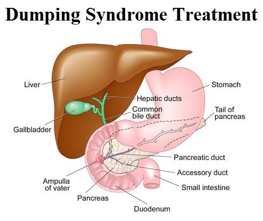 Dumping Syndrome Treatment Market