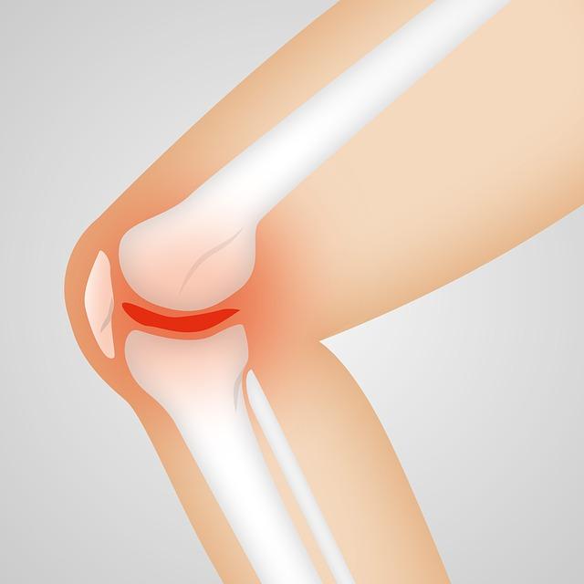Total Knee Replacement Market