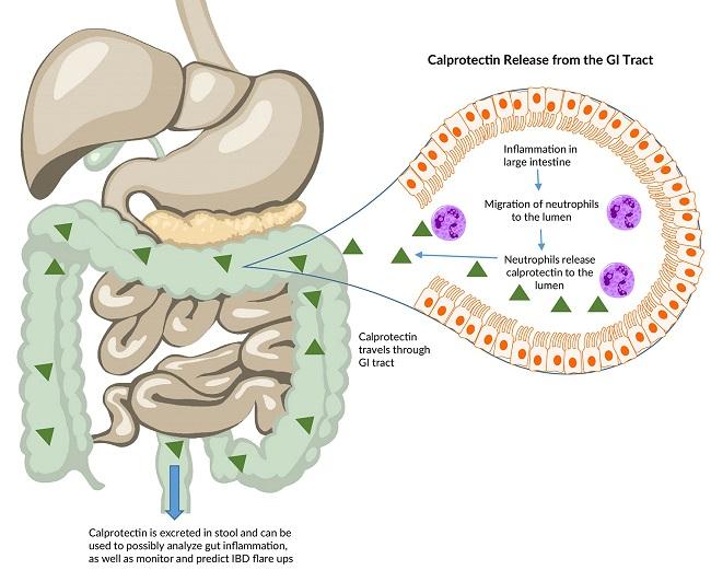 US IBD Therapeutics Market