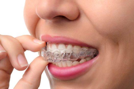 Herndon Family Dental Promotes a Brand-new Website